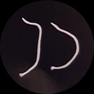 猫の寄生虫 内部寄生虫 について どうぶつのお医者さん Ocean S Animal Clinic