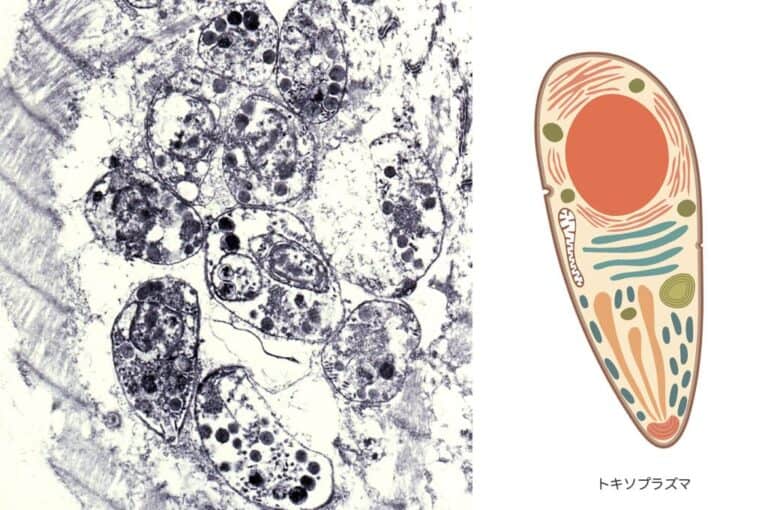 トキソプラズマ